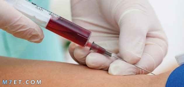 What is ASO analysis?