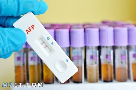 What is an AFP . analysis?